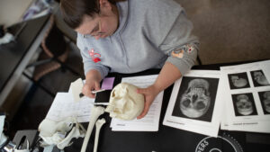 Kendall Rafferty examines model of skull